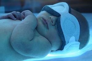 درمان زردی نوزاد با مهتابی